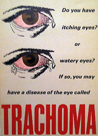 Trachoma1